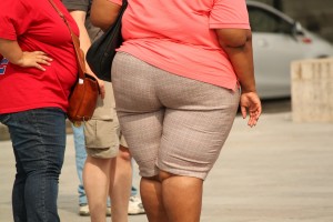 obese-people